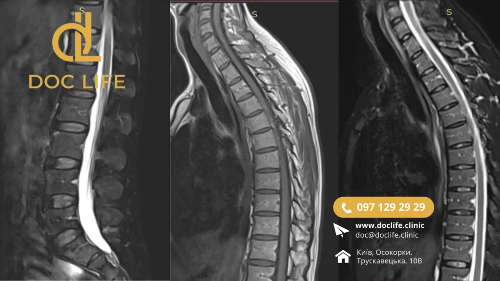 Скринінг хребта МРТ клініка Док Лайф Київ